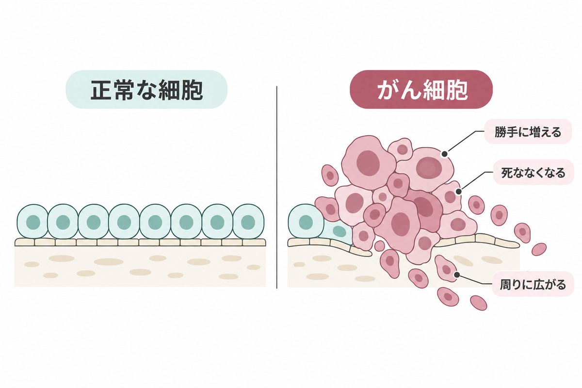 正常な細胞とがん細胞の対比図。正常な細胞は一層に並び、がん細胞は勝手に増えて周りに広がっている