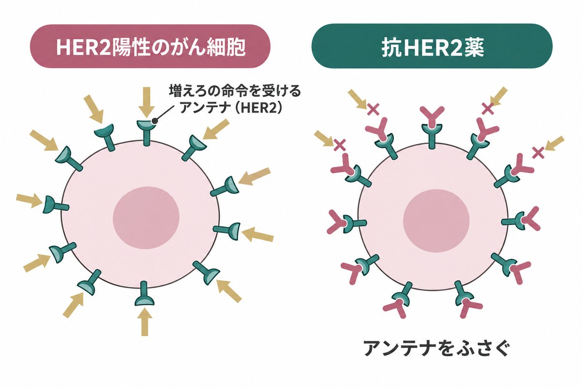 HER2陽性のがん細胞は、増えろの命令を受けるアンテナ（HER2）をたくさん持つ。抗HER2薬はそのアンテナをふさぐ