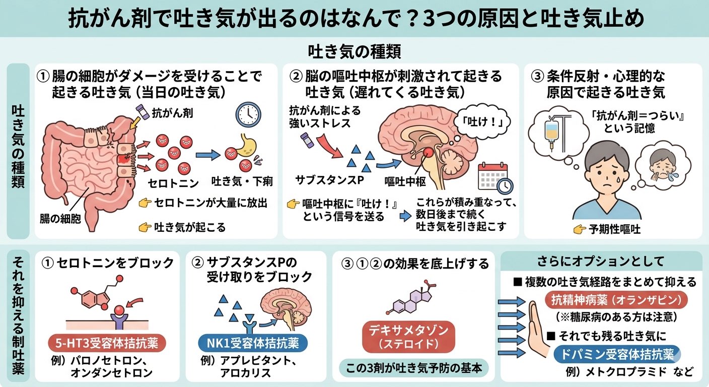 抗がん剤で吐き気が出るのはなんで？3つの原因と吐き気止め